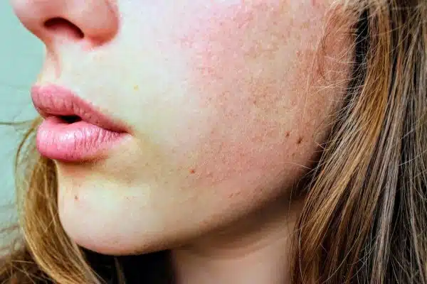 Maquillage pour peau sensible : Conseils et astuces pour un teint parfait