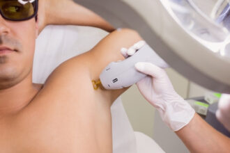 Pourquoi de plus en plus d’hommes choisissent l’épilation laser ?